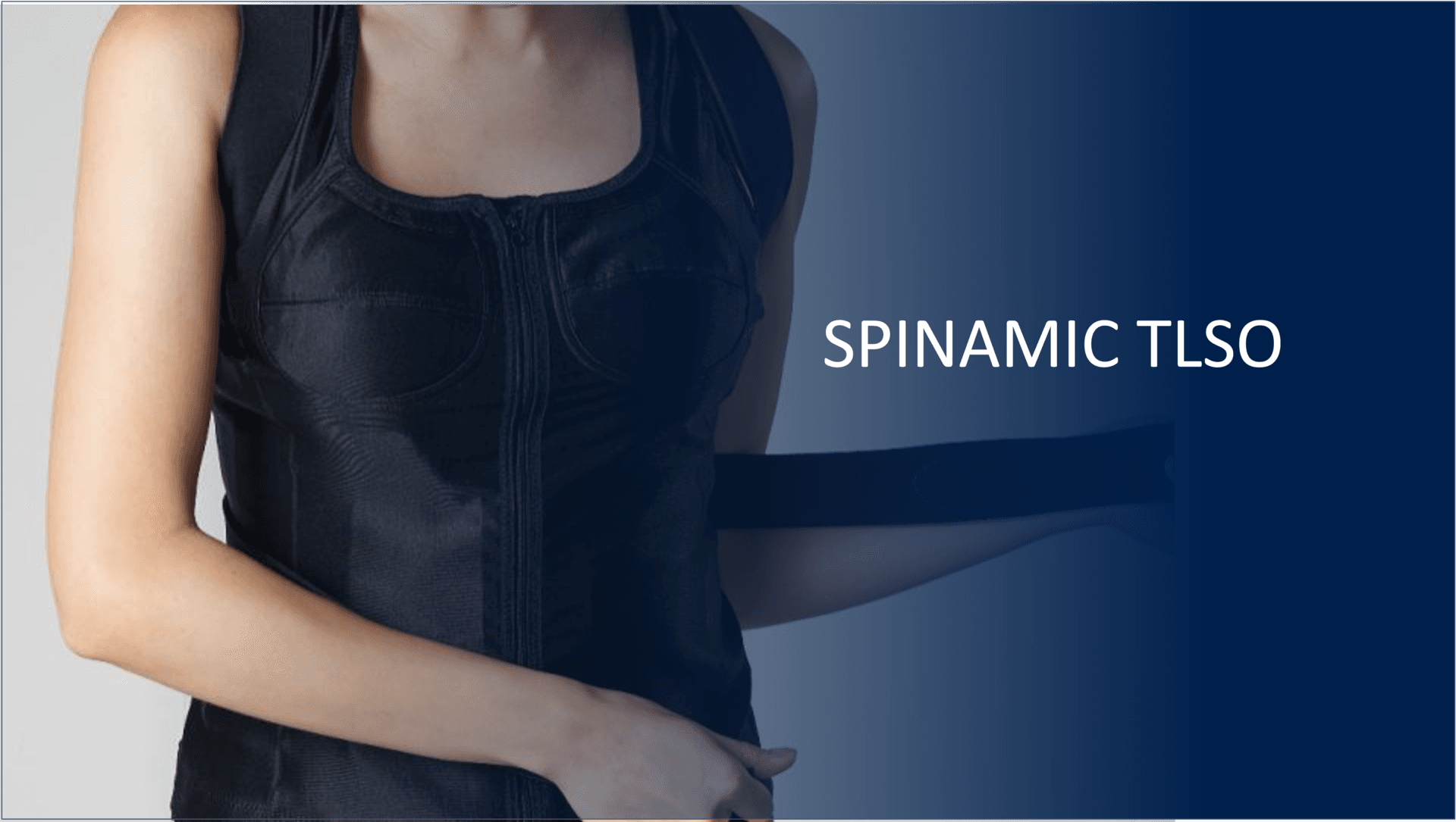 Spinamic TLSO front view